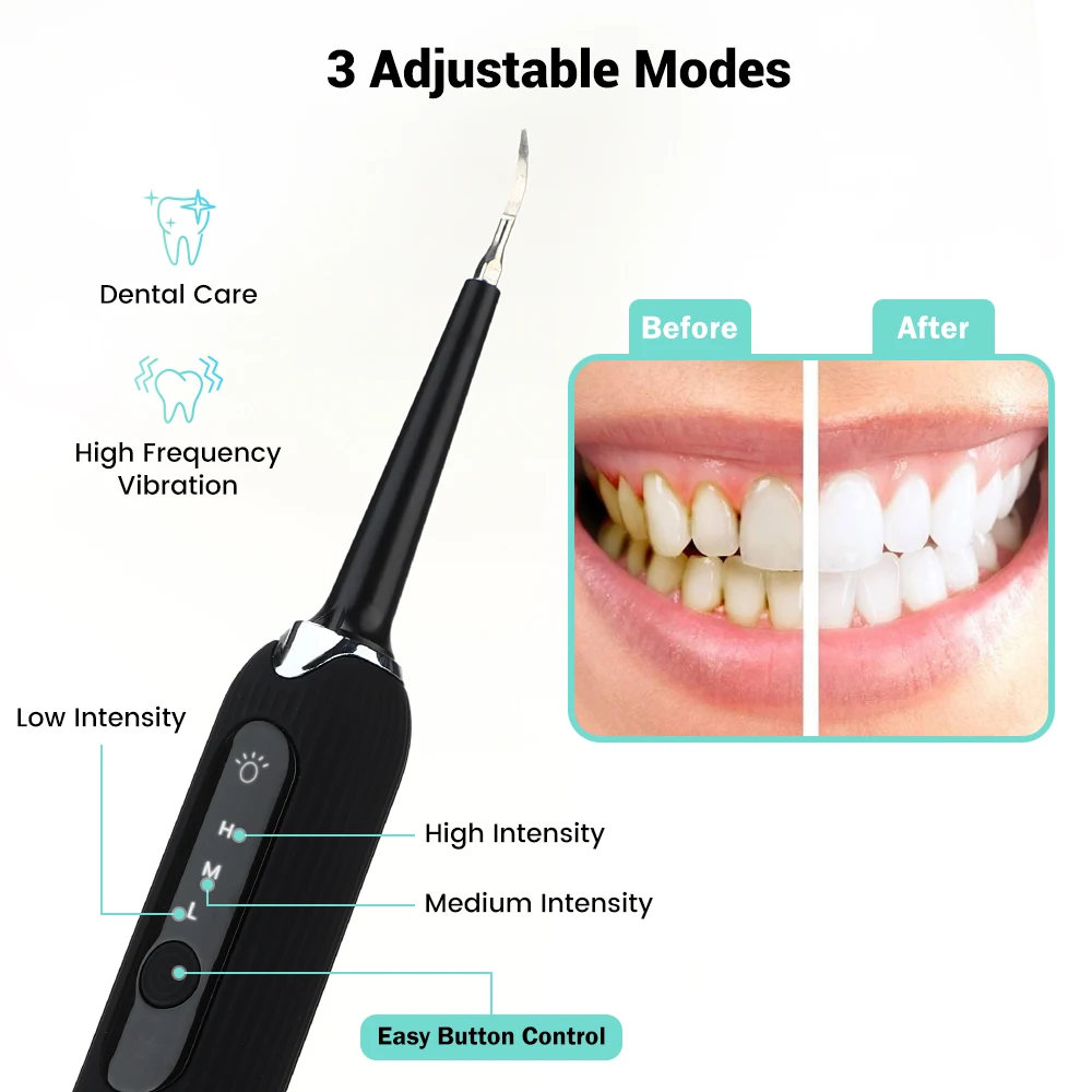 Electric Cu Ultrasunete Vibrații De Dinti Electrica Calcul Remover Vibrații Dinte Petele De Tartru Placa De Curățare Dentare Orale Instrument 2