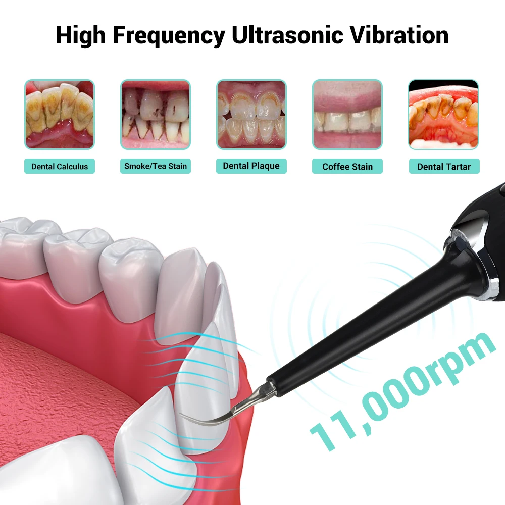 Electric Cu Ultrasunete Vibrații De Dinti Electrica Calcul Remover Vibrații Dinte Petele De Tartru Placa De Curățare Dentare Orale Instrument 5