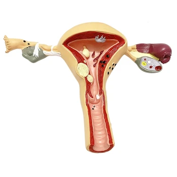 Omului Uter Și Ovar Model, Organ De Reproducere Feminin Model, De Sex Feminin Organ Genital, Medicina De Predare Anatomice