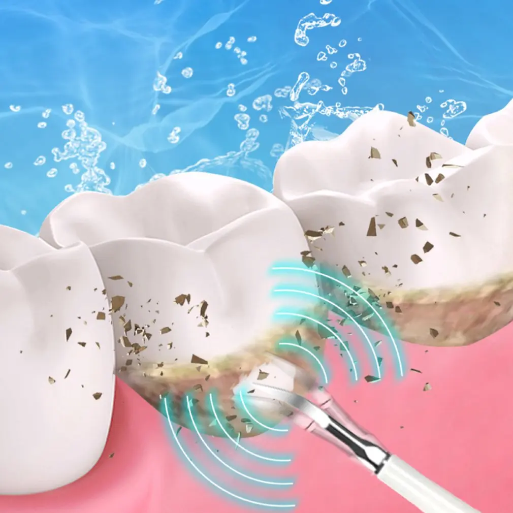 Electric Cu Ultrasunete Tartru Dentar Remover Curat Dintii De Curățare A Dinților Albirea Dintilor Scala Tartrul Dentar Remover Îngrijire Orală 3